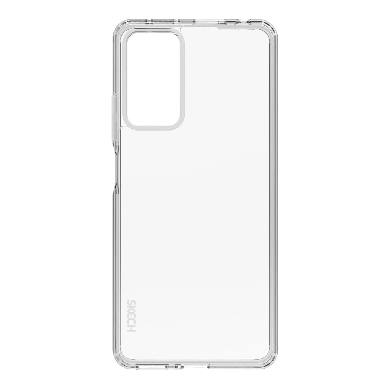 קיט מבית SKECH הכולל כיסוי אחורי + מגן מסך REDMI NOTE 11 PRO/11 PRO 5G